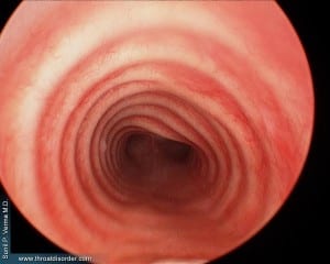 Inside the throat or trachea as its better known.
